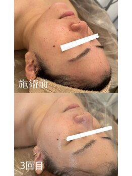 サロン ド ミニョン(salon de mignon)/驚きのbefore after♪