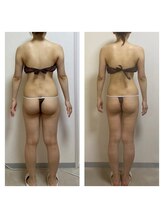 ホズリル(Hozril)/全身痩身エステ１２回の効果！！