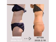 腸と頭の雰囲気（続けることで結果が見える◎結果重視のトリートメント）