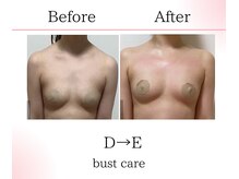 サロンツキ(salon tuki)/バストケア症例