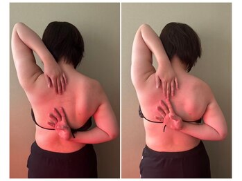 マイティー整骨院 ココア(CoCoa)/肩甲骨洗浄