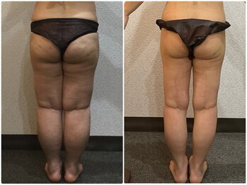 美容整体 ウェリナ 蟹江院/小顔矯正/骨盤矯正/美脚サロン 