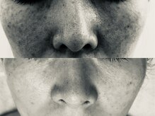 エステ ラミ(Esthe' l'ami)/陶肌トリートメント