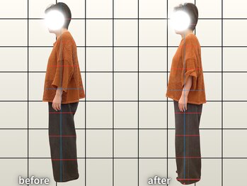 アクティブフィジオ 武蔵小杉/猫背・巻き肩・肩こり・肩甲骨