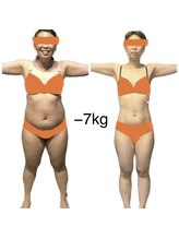 ディナトス/20代女性