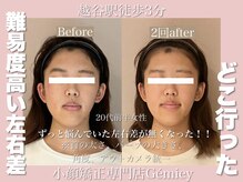 ジェイミー(Gemiey)/左右差でお悩みのお客様