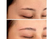 ジーニー(Genie)/ハリウッドブロウリフト