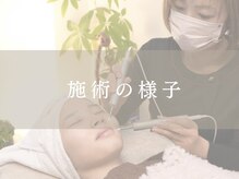サロン ド ジョワ(salon de joie)/施術の様子