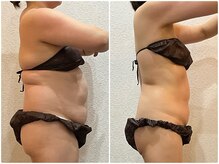 美容整体 ウェリナ 蟹江院/小顔矯正/骨盤矯正/美脚サロン 