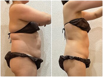 美容整体 ウェリナ 蟹江院/小顔矯正/骨盤矯正/美脚サロン