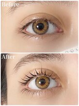 レピア 郡山駅前店/韓国式LEPIA Before&After