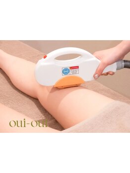 デリケート部分の脱毛/Vライン/VIO