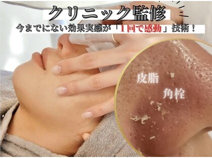 ラトワ(LATOWA)の写真