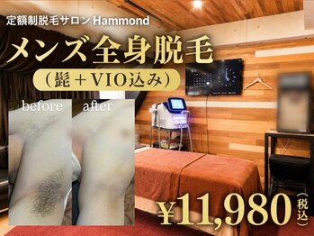 ハモンド(Hammond)の写真/コツコツ美容脱毛で叶える、清潔感のある肌へ。ヒゲ・全身・VIOまで対応!定額制で無理なく通えるサロン
