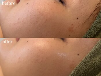 リボーン 浜松(reborn)/