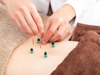 ハリッシュの写真/肩こり・腰痛・自律神経の乱れによる不調・女性特有のお悩みなど！様々なお悩みに幅広く対応します◎