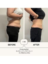 オーシャン整骨院(OCEAN整骨院)/６ヶ月コース