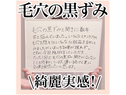ルネッタ(Lunetta)の写真