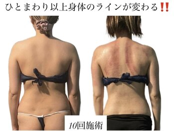 痩身革命 大宮店/ダイエットリンパマッサージ