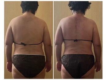 マイティー整骨院 ココア(CoCoa)/活性リンパ洗浄