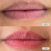 ソセイラボ ビューティー(SOSEI Lab. Beauty)