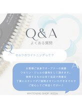 ホワイトニングショップ 池田店/【よくある質問】