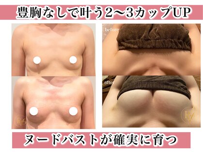 ラヴィス(ravis)の写真