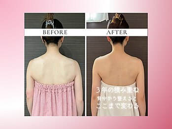 リスブランビューティー(Lys Blanc Beauty)/９０分コルギ／３年の変化