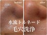 【いちご鼻卒業/毛穴ケアに】トルネード水流洗浄で感動のなめらか素肌体験◎