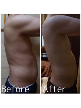 トータルメンズエステ キング(KING)/ポッコリお腹撃退