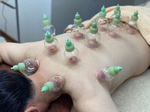 浅間口はりきゅう院/血流アップにも◎