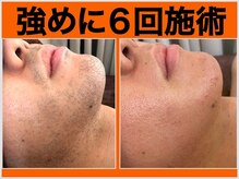 ファシネイト 新宿本店(Fascinate)