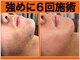 ファシネイト 新宿本店(Fascinate)の写真