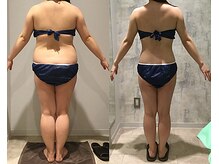 アユアランリンク 錦糸町店/E様：背面