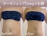 【脂肪燃焼/引き締め】サーモシェイプDeep（お腹40分）＋カウンセリング30分