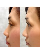 サンライズ(SUNRISE)/