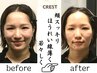 【人気No.2！】《小顔矯正×小顔コルギ×頭蓋骨矯正》50分¥9,800→¥3,800