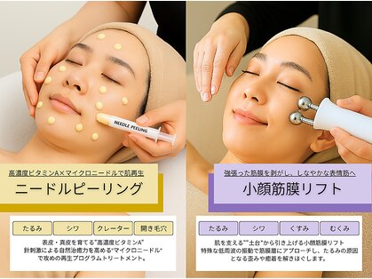 ベストベル(BestBelle)の写真