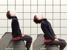 アクティブフィジオ 武蔵小杉/症例3