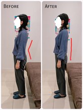 ヒダマリ(HIDAMARI)/骨盤矯正ビフォーアフター★