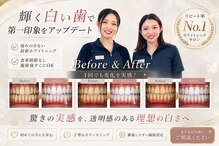 ホワイトニングショップ 島根店