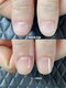 クーラ アンド ベリッシモ(Cura&Bellissimo)の写真/爪の縦筋にお悩みの方へ。元町・神戸三宮で自爪育成と深爪補正を体験。一度で効果実感あり◎
