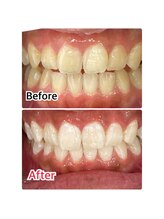 ホワイトニングスタイル 柏店/