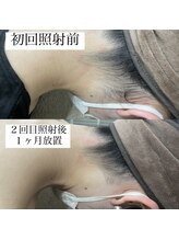 テンパ ビューティー(+10%beauty)/効果写真