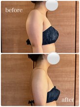 カレント(current)/ブライダルエステ¥13200