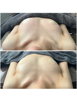 モア(moa)/バストの左右差改善!