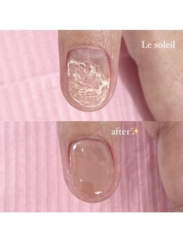 ル ソレイユ(Le soleil)/爪の悩み、ご相談ください!