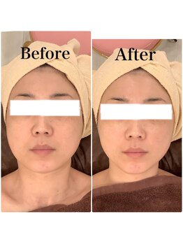 スペチアーレ 夙川/鳴り止まない人気無制限ハイリフ