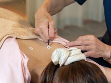 ヴェッセル(Vessel)/