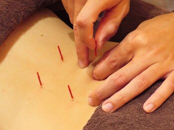 リファイン 渋谷 メガドンキ店/鍼施術もご予約可能となりました